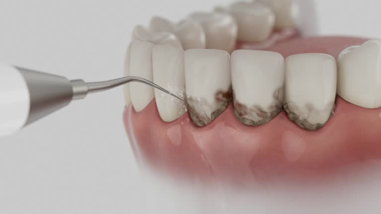 Reliable Dental contractor in Forsyth, GA by Dentist Open Now